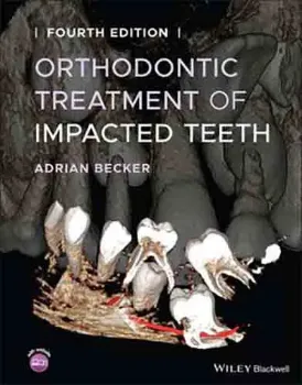 Picture of Book Orthodontic Treatment of Impacted Teeth