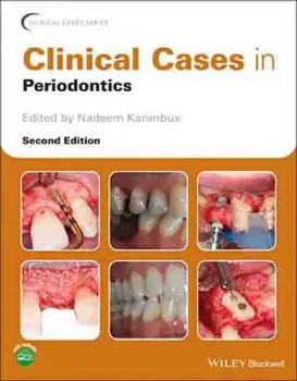Imagem de Clinical Cases in Periodontics