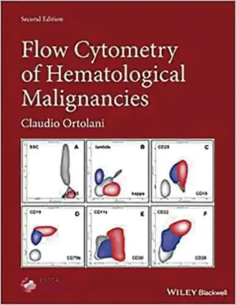 Imagem de Flow Cytometry of Hematological Malignancies