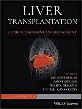 Imagem de Liver Transplantation: Clinical Assessment and Management
