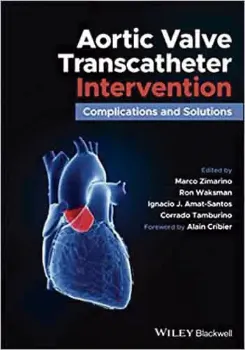 Imagem de Aortic Valve Transcatheter Intervention: Complications and Solutions