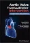 Imagem de Aortic Valve Transcatheter Intervention: Complications and Solutions
