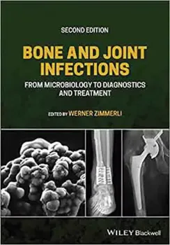 Picture of Book Bone and Joint Infections: From Microbiology to Diagnostics and Treatment