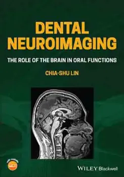 Imagem de Dental Neuroimaging: The Role of the Brain in Oral Functions