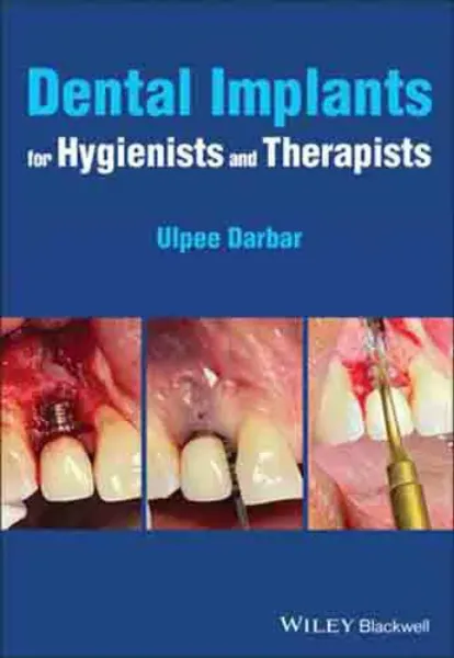 Imagem de Dental Implants for Hygienists and Therapists