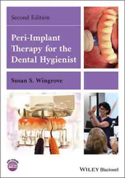 Imagem de Peri-Implant Therapy for the Dental Hygienist