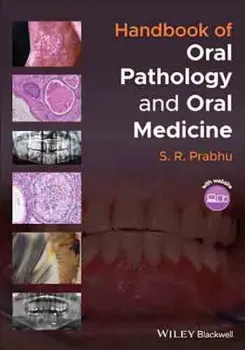 Imagem de Handbook of Oral Pathology and Oral Medicine