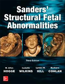 Imagem de Sanders' Structural Fetal Abnormalities