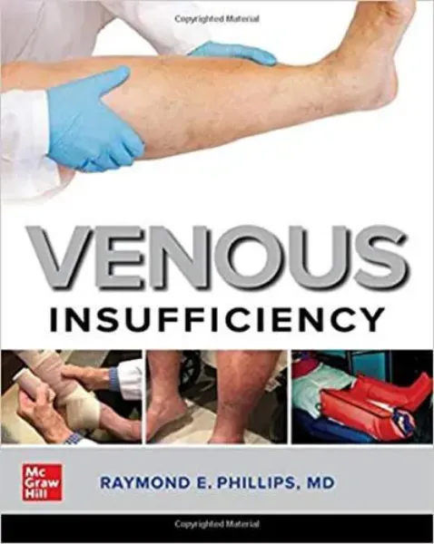 Imagem de Venous Insufficiency