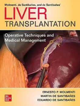 Imagem de Liver Transplantation: Operative Techniques and Medical Management