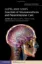 Imagem de Gupta and Gelb's Essentials of Neuroanesthesia and Neurointensive Care