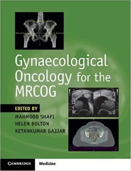 Imagem de Gynaecological Oncology for the MRCOG
