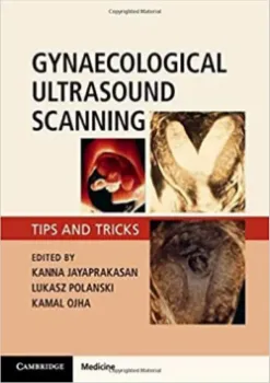 Picture of Book Gynaecological Ultrasound Scanning: Tips and Tricks