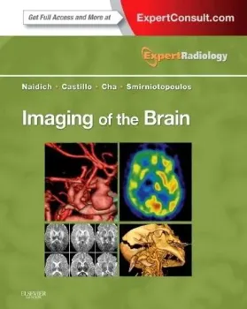 Picture of Book Imaging of the Brain