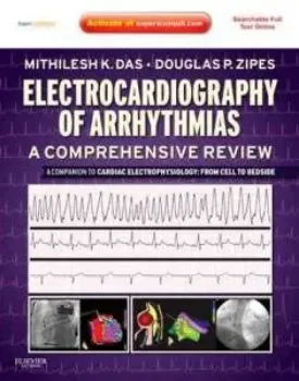 Picture of Book Electrocardiography of Arrhythmias: A Comprehensive Review