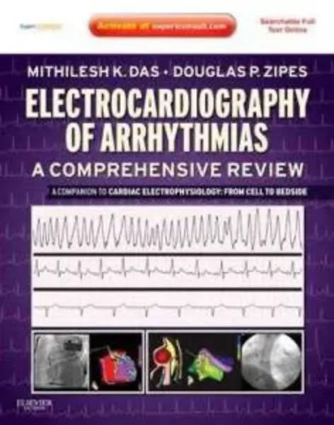 Imagem de Electrocardiography of Arrhythmias: A Comprehensive Review