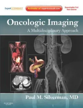 Imagem de Oncologic Imaging: A Multidisciplinary Approach 1st edition