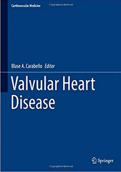 Imagem de Valvular Heart Disease