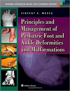 Imagem de Principles and Management of Pediatric Foot and Ankle Deformities and Malformations