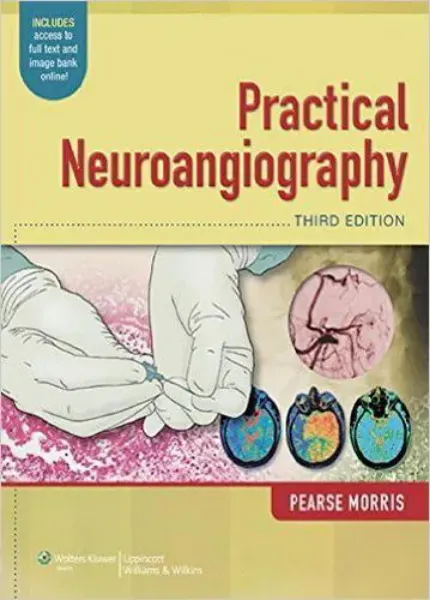 Imagem de Practical Neuroangiography
