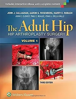 Picture of Book The Adult Hip: The Adult Hip: Hip Arthroplasty Surgery ( 2 Vols. Set)