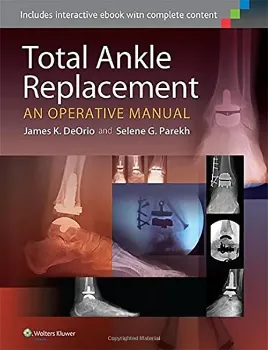 Imagem de Total Ankle Replacement: An Operative Manual