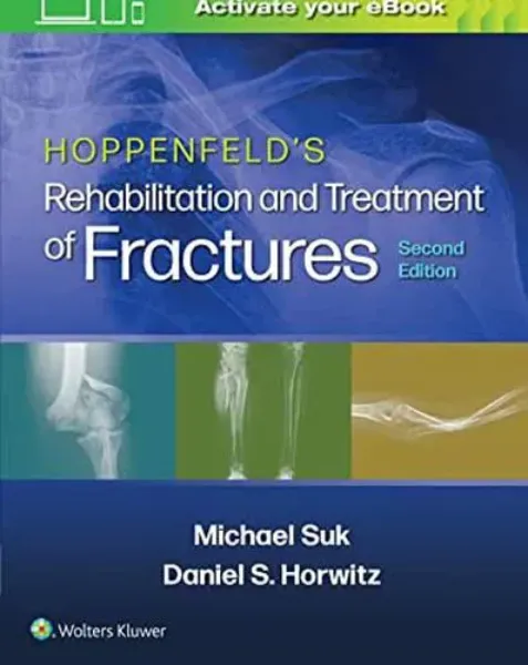 Imagem de Hoppenfeld's Treatment and Rehabilitation of Fractures