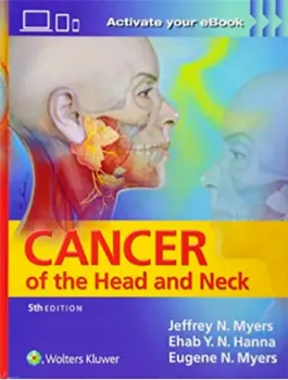 Imagem de Cancer of the Head and Neck