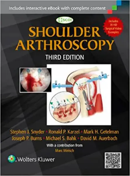 Imagem de Shoulder Arthroscopy