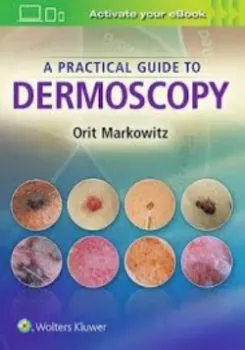 Imagem de A Practical Guide to Dermoscopy