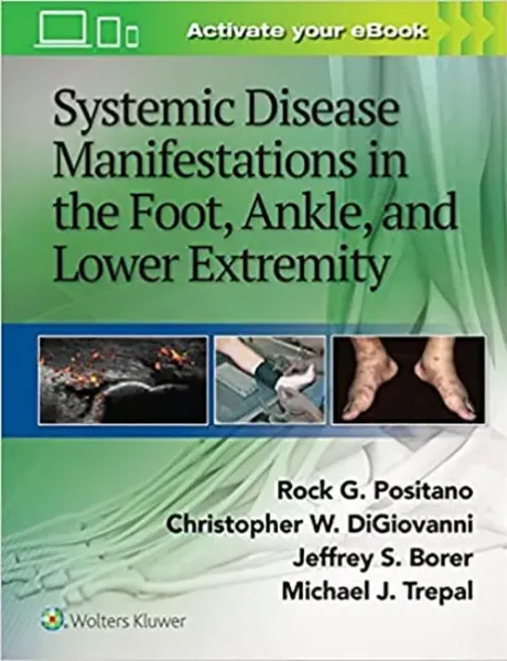 Imagem de Systemic Disease Manifestations in the Foot, Ankle and Lower Extremity