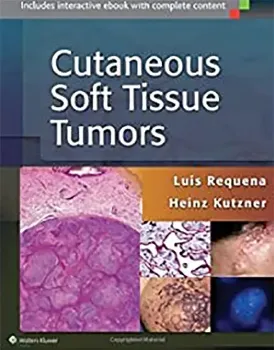 Picture of Book Cutaneous Soft Tissue Tumors