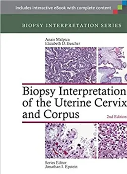Picture of Book Biopsy Interpretation of the Uterine Cervix and Corpus