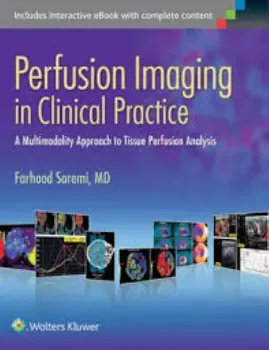 Picture of Book Perfusion Imaging in Clinical Practice