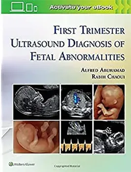 Imagem de First Trimester Ultrasound Diagnosis of Fetal Abnormalities