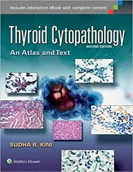 Picture of Book Thyroid Cytopathology
