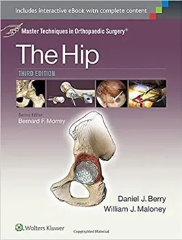Imagem de Master Techniques in Orthopaedic Surgery: The Hip