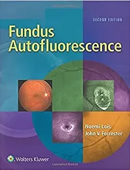 Picture of Book Fundus Autofluorescence