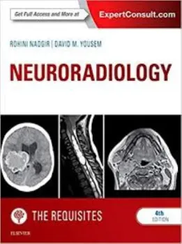 Imagem de Neuroradiology: The Requisites