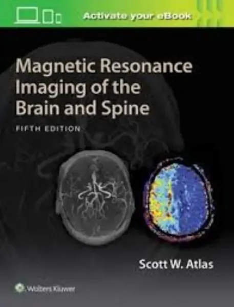 Imagem de Magnetic Resonance Imaging of the Brain and Spine
