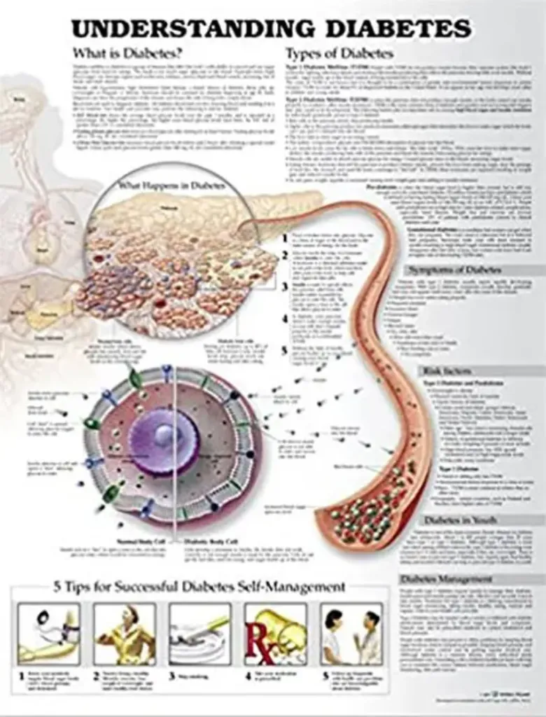 Imagem de Understanding Diabetes Anatomical Chart
