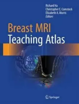 Picture of Book Breast MRI Teaching Atlas