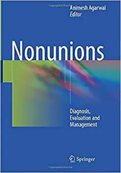 Picture of Book Nonunions: Diagnosis, Evaluation and Management