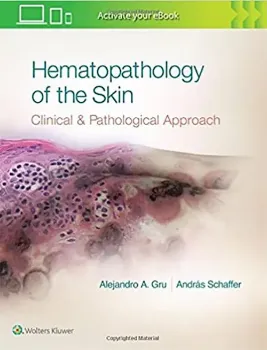 Imagem de Hematopathology of the Skin: A Clinical and Pathologic Approach