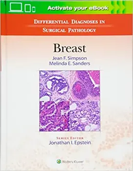 Imagem de Differential Diagnoses in Surgical Pathology: Breast