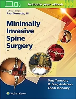 Imagem de Minimally Invasive Spine Surgery