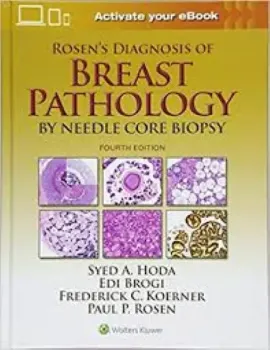 Picture of Book Rosen's Diagnosis of Breast Pathology by Needle Core Biopsy