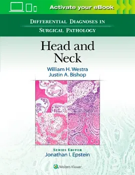 Imagem de Differential Diagnoses in Surgical Pathology: Head and Neck