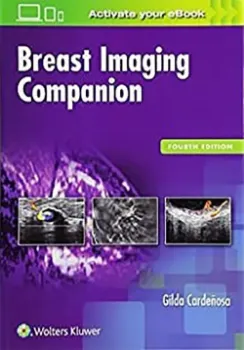 Imagem de Breast Imaging Companion