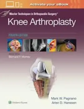 Imagem de Master Techniques in Orthopedic Surgery: Knee Arthroplasty